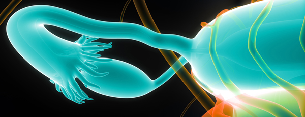 Рак яичников