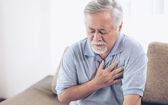 Мерцательная аритмия