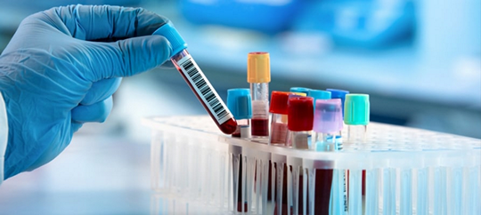 Непереносимость лактозы