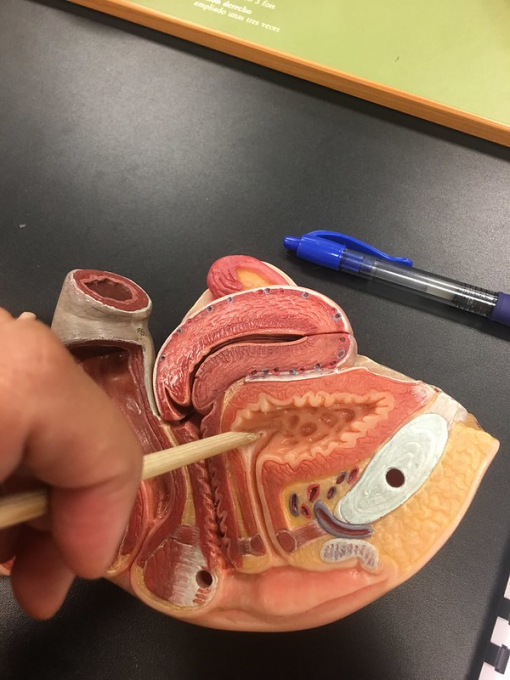 Рак мочеточников