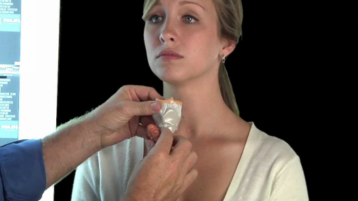 Рак паращитовидной железы