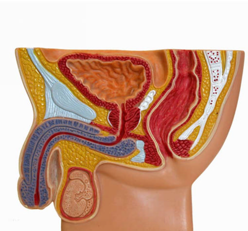 Варикоцеле