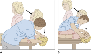 Причины, симптомы и лечение головокружения