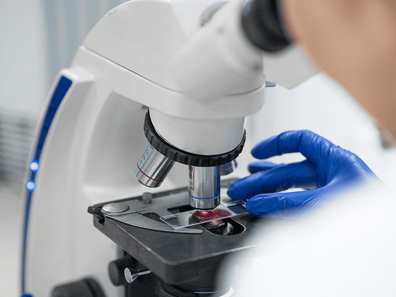 Рабдомиосаркома-3