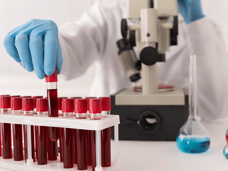 Миелодиспластический синдром-3