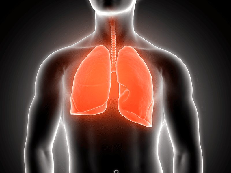 Мелкоклеточный рак легких-3