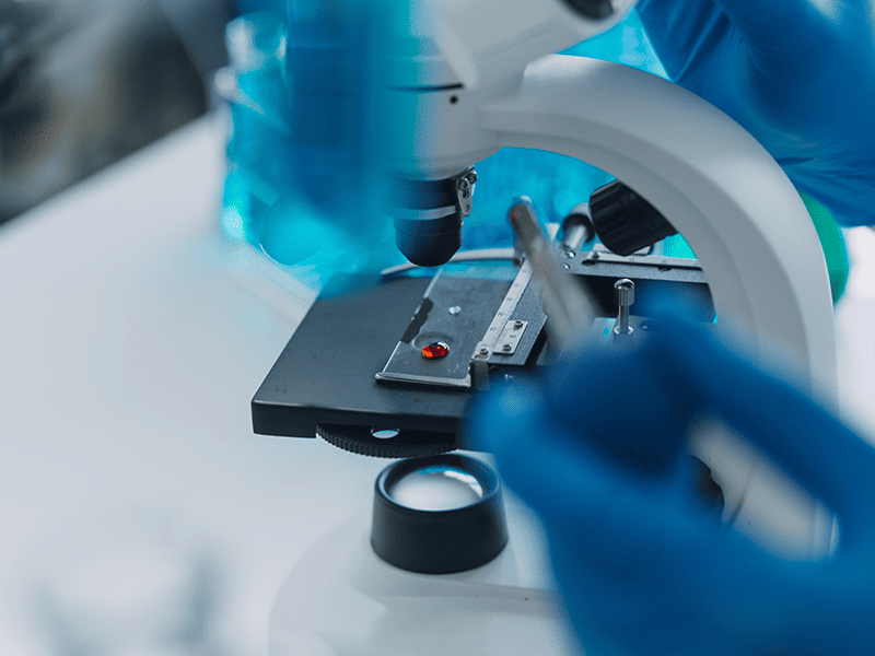 Мелкоклеточный рак легких-7