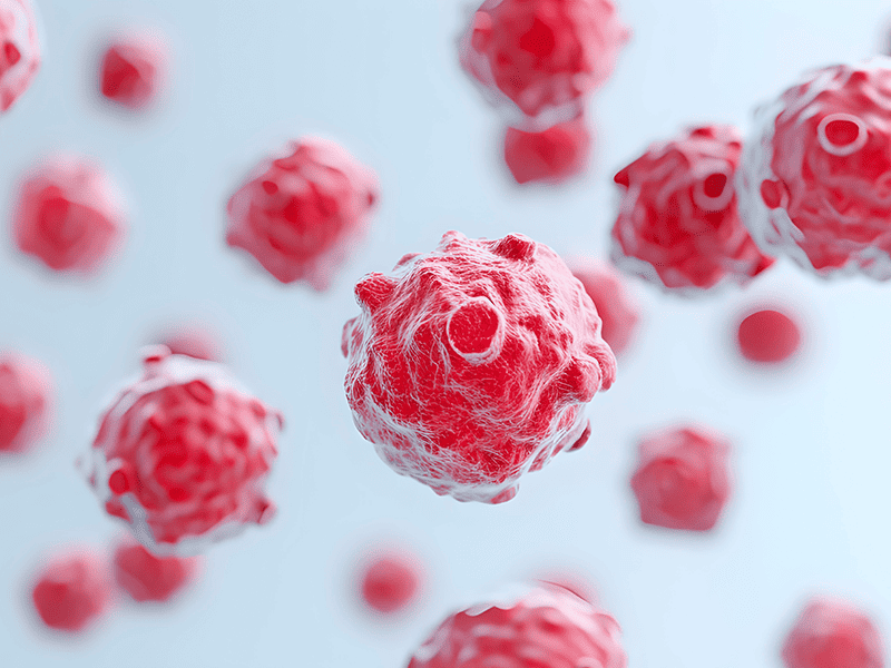 Миелодиспластический синдром-1