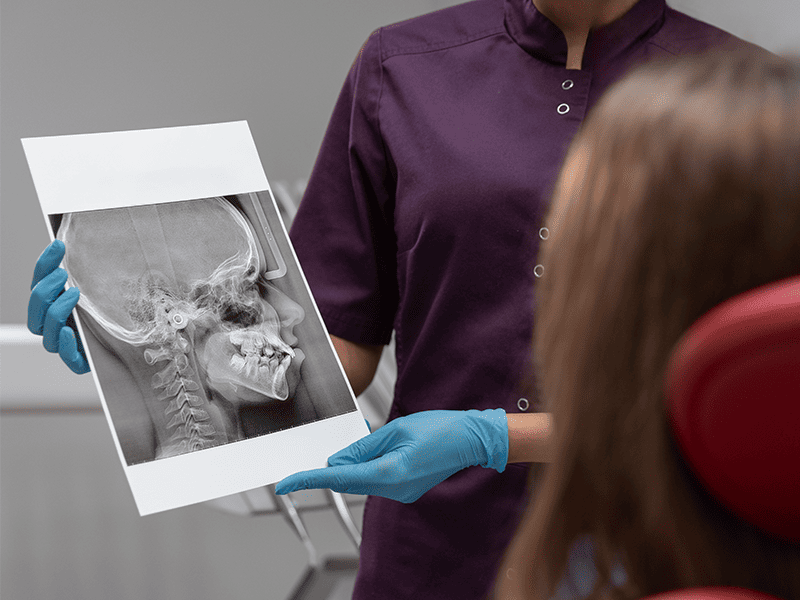 Рак полости рта-3