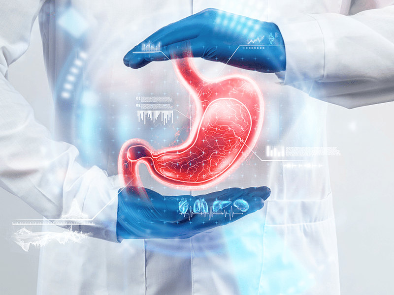 Аденокарцинома желудка-4