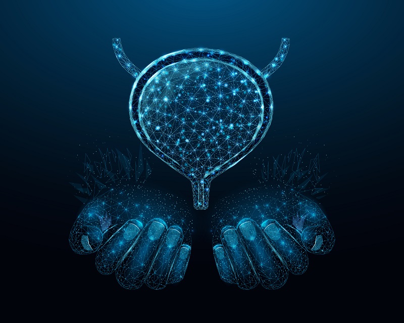 Рак мочевого пузыря-4 Рак мочевого пузыря-4